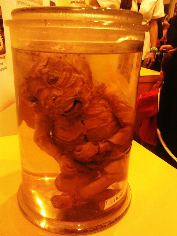 Museo Anatómico Pedro Ara